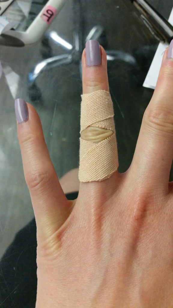 Taping helps to prevent and treat the most common finger injuries, e.g. A2 pulley injury